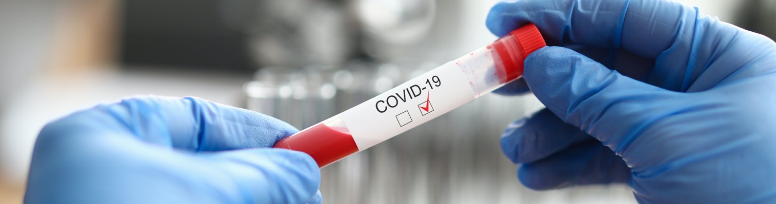 POLYPOINT_Blog_Covid-Test_HFR_Headerbild